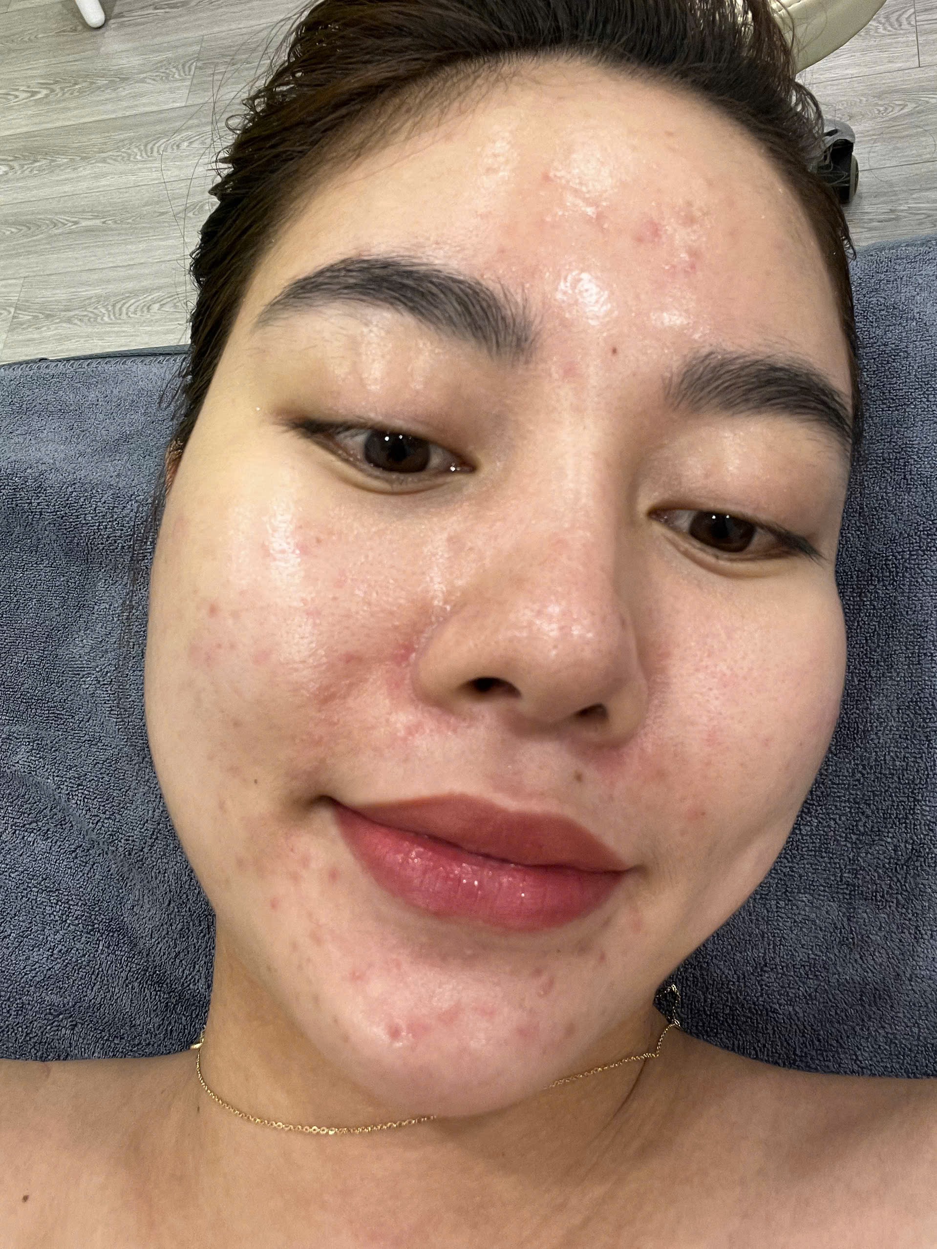 Phùng Nguyên Bảo  30 tuổi - Hà Nội